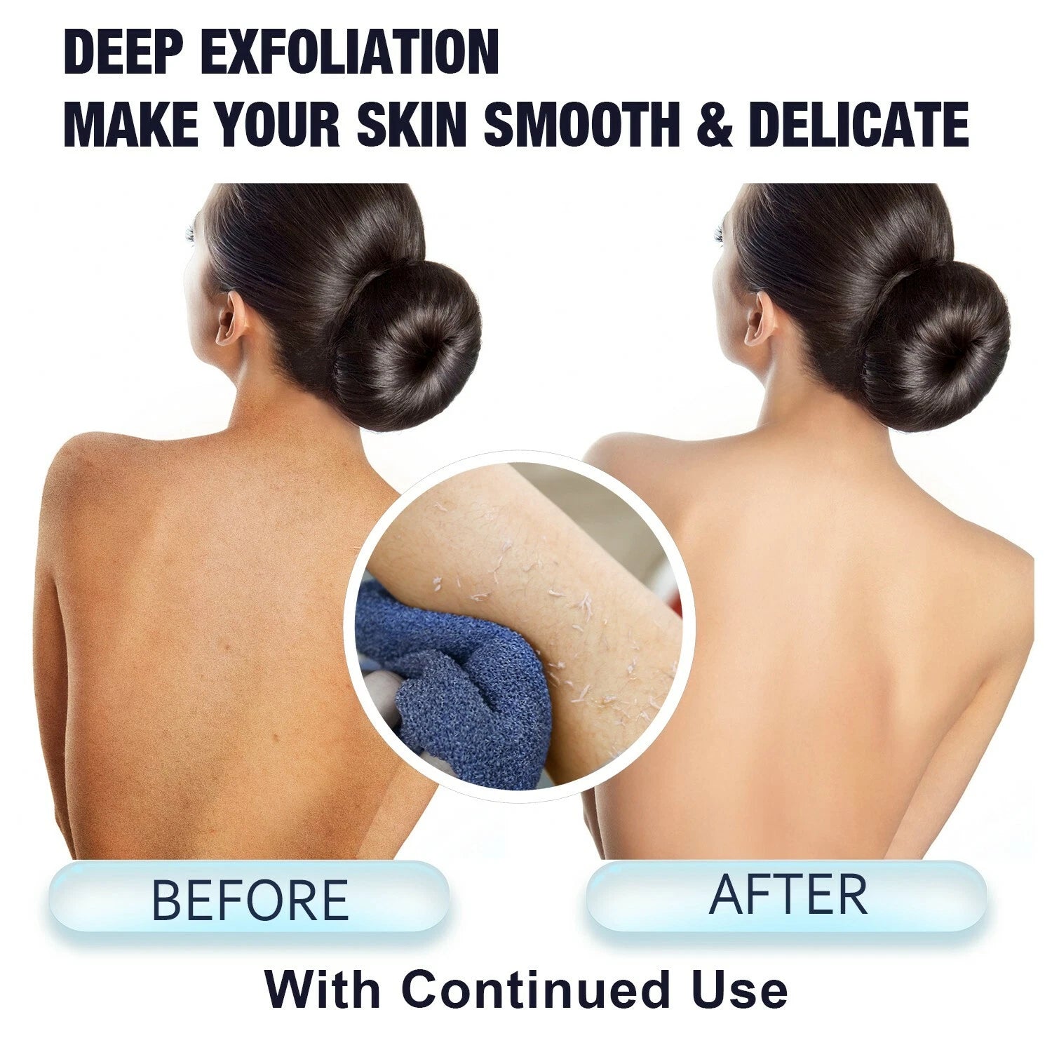EvridWear Exfoliating Back Scrubber for Shower Bath Shower Spa Skin One Size