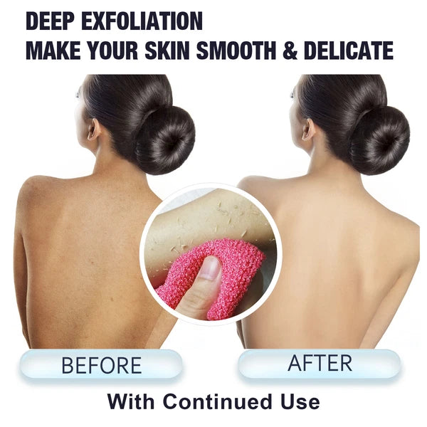 EvridWear Exfoliating Back Scrubber for Shower Bath Shower Spa Skin One Size